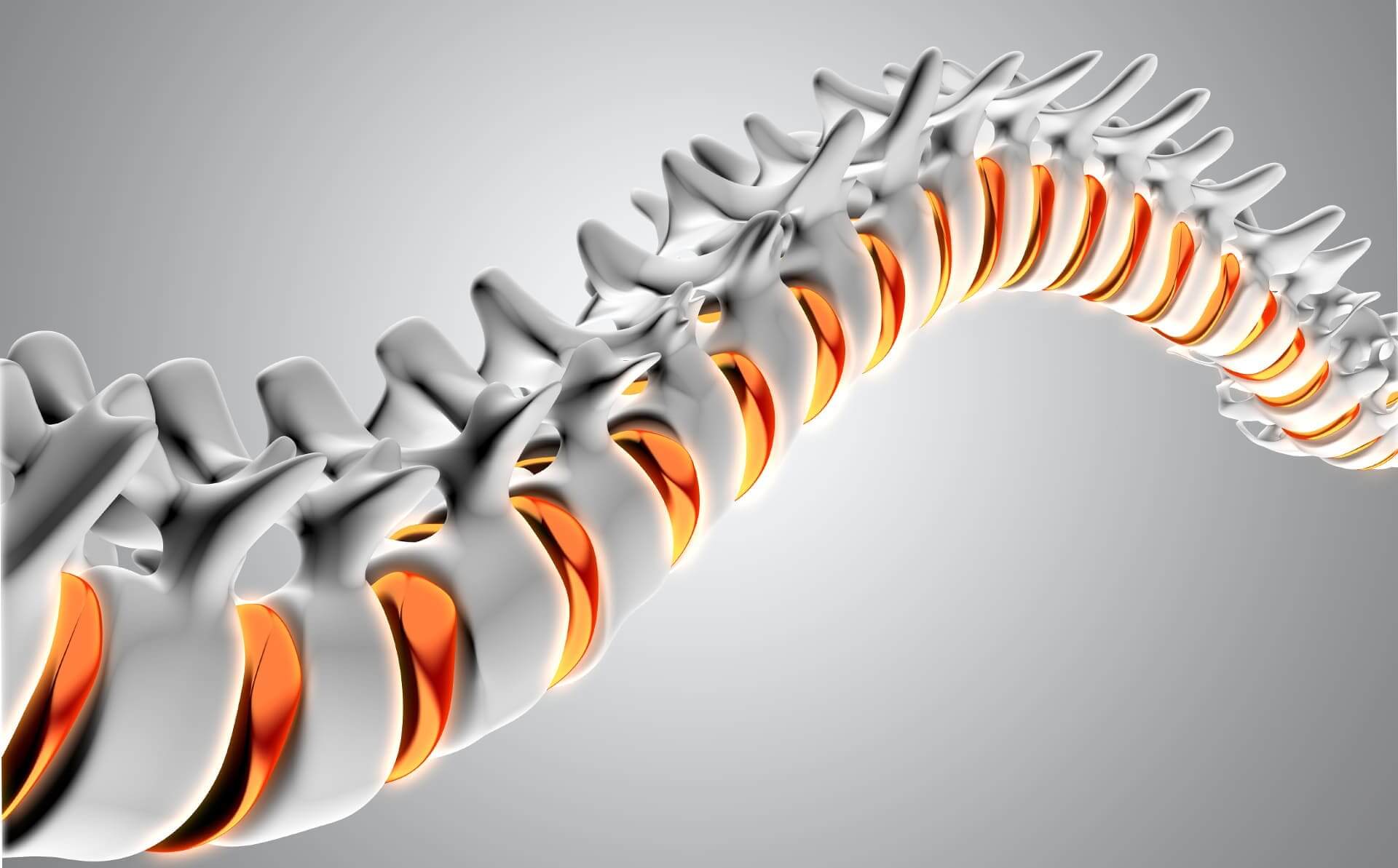 Dolor de columna en CDMX